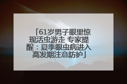 61岁男子眼里惊现活虫游走 专家提醒：夏季眼虫病进入高发期注意防护